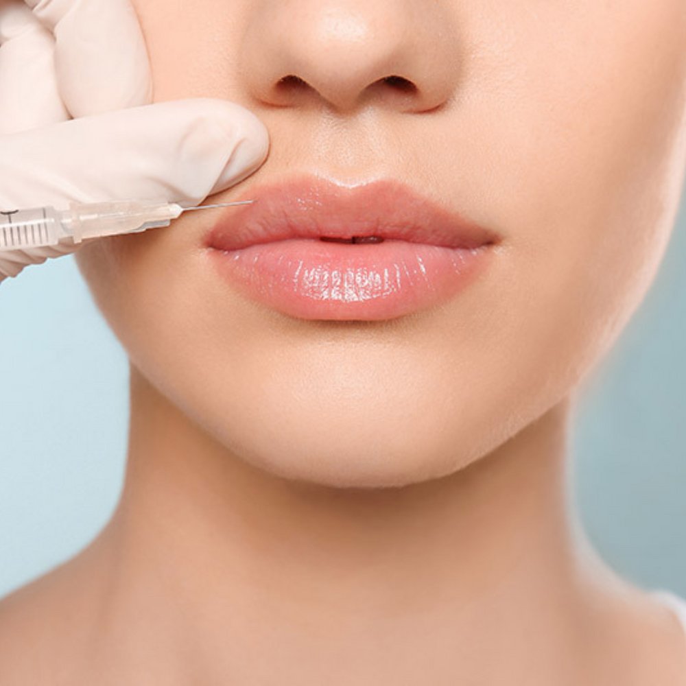 Lip Rejuvenation & Augmentation treatment in Dubai