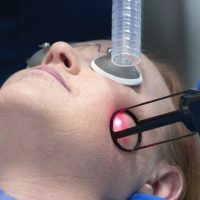 laser resurfacing in skin experts polyclinic in dubai