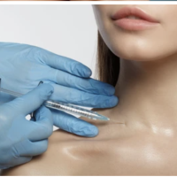 Neck Rejuvenation Treatment